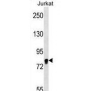 Eukaryotic Translation Initiation Factor 4B (EIF4B) Antibody