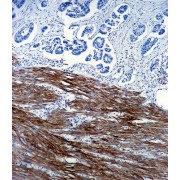 Actin, Alpha Skeletal Muscle (ACTA1) Antibody