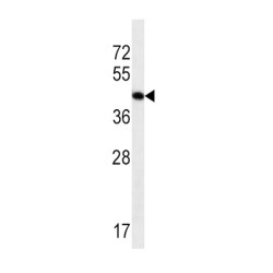 Actin, Alpha Skeletal Muscle (ACTA1) Antibody