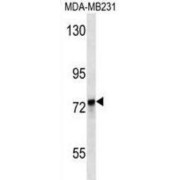 Kelch Like ECH Associated Protein 1 (KEAP1) Antibody