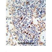 Kappa Light Chain Antibody