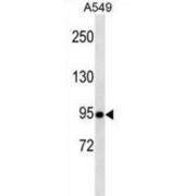 Transducin-Like Enhancer Protein 1 (TLE1) Antibody