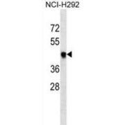 T-Box Transcription Factor T (TBXT) Antibody