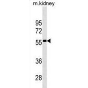 T-Box Transcription Factor T (TBXT) Antibody