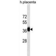 Gastrulation Brain Homeobox 2 (GBX2) Antibody