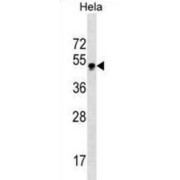 Gastrulation Brain Homeobox 2 (GBX2) Antibody