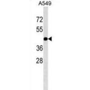 Gap Junction Protein Gamma 2 (GJC2) Antibody