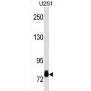 Ribosomal Protein S6 Kinase A3 (RPS6KA3) Antibody