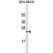 Mucin 1 (MUC1) Antibody