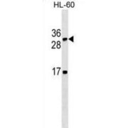 WB analysis of HL-60 cell line lysates.