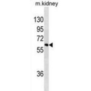 WB analysis of Mouse kidney tissue lysates, using SPRED1 Antibody.