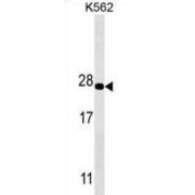 Proteasome Subunit Alpha Type 5 (PSMA5) Antibody