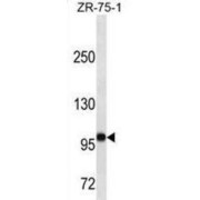 Alpha-(1,3)-Fucosyltransferase 4 (FUT4) Antibody