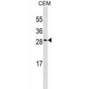 C-Reactive Protein (CRP) Antibody