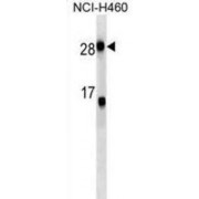 C-Reactive Protein (CRP) Antibody