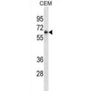 Fc Fragment of IgG Low Affinity IIIa Receptor (FCGR3A) Antibody