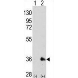 Transcription Factor SOX-2 (SOX2) Antibody
