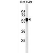 Antithrombin-III (SERPINC1) Antibody