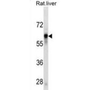 Antithrombin-III (SERPINC1) Antibody