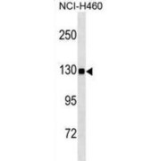 Ubiquitin Specific Peptidase 8 (USP8) Antibody