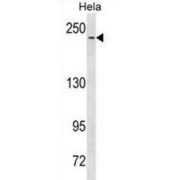 Neurogenic Locus Notch Homolog Protein 3 (NOTCH3) Antibody