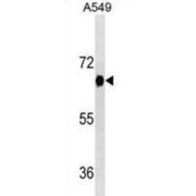 Dual Specificity Tyrosine-Phosphorylation-Regulated Kinase 2 (DYRK2) Antibody