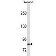 Hepatocyte Growth Factor (HGF) Antibody