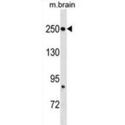 Fatty Acid Synthase (FASN) Antibody