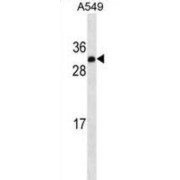 Insulin-Like Growth Factor II (IGF2) Antibody