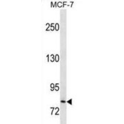 Catenin Beta 1 (CTNNB1) Antibody