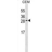 Erythropoietin (EPO) Antibody