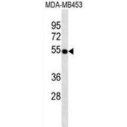 Vitamin D3 Receptor (VDR) Antibody