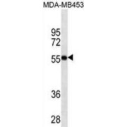 Vitamin D3 Receptor (VDR) Antibody