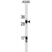 HKLK3 Antibody