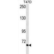 Vitronectin (VTN) Antibody