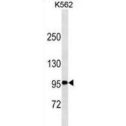 Tumor Necrosis Factor Receptor Superfamily Member 8 / CD30 (TNFRSF8) Antibody