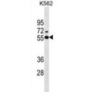 Estrogen Receptor Beta (ESR2) Antibody