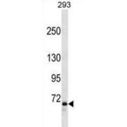 Forkhead Box Protein P2 (FOXP2) Antibody