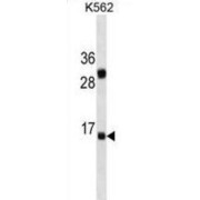 Interleukin 2 (IL2) Antibody