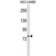 Hepatocyte Nuclear Factor 1 Alpha (HNF1A) Antibody