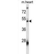 V-Set And Immunoglobulin Domain-Containing Protein 8 (VSIG8) Antibody