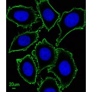 Mast/Stem Cell Growth Factor Receptor Kit (KIT) Antibody