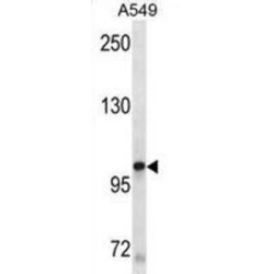 Mast/Stem Cell Growth Factor Receptor Kit (KIT) Antibody