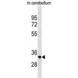 Proteolipid Protein 1, Myelin (PLP1) Antibody