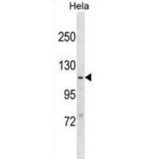 Major Vault Protein (MVP) Antibody