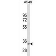 Myoblast Determination Protein 1 (MYOD1) Antibody