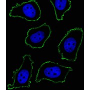 Myeloid Cell Surface Antigen CD33 (CD33) Antibody