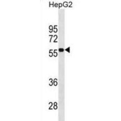 Myeloid Cell Surface Antigen CD33 (CD33) Antibody