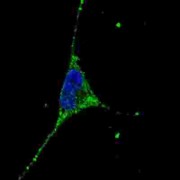 Podocalyxin (PODXL) Antibody