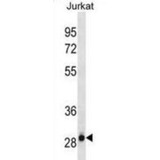 Hydroxyacylglutathione Hydrolase (HAGH) Antibody